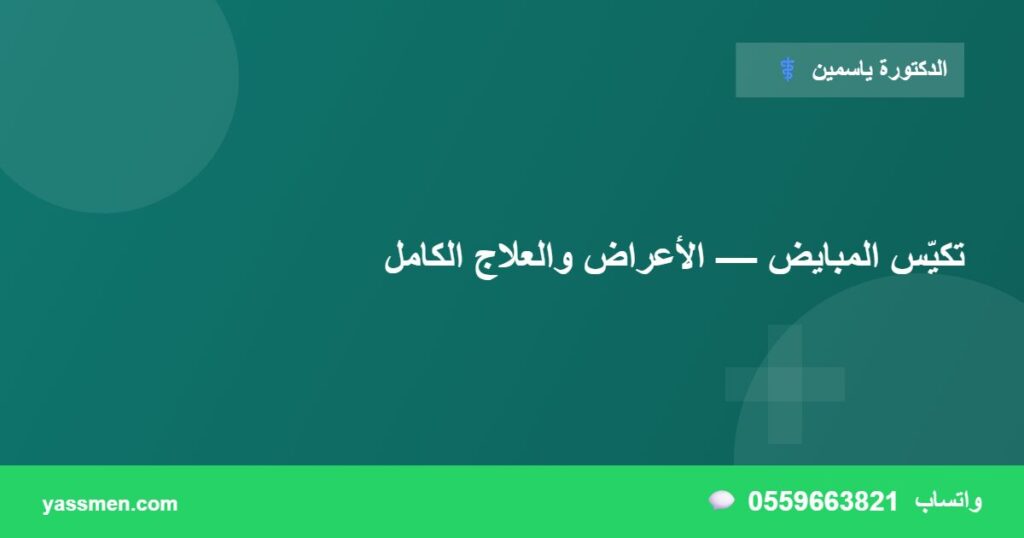 تكيّس المبايض — الأعراض والعلاج الكامل
